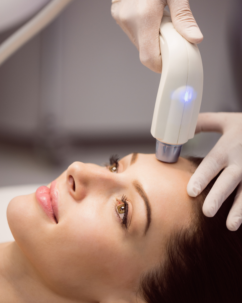 Exilis Elite 1