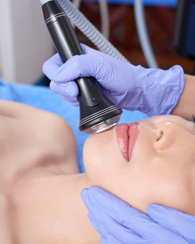 HIFU Treatment