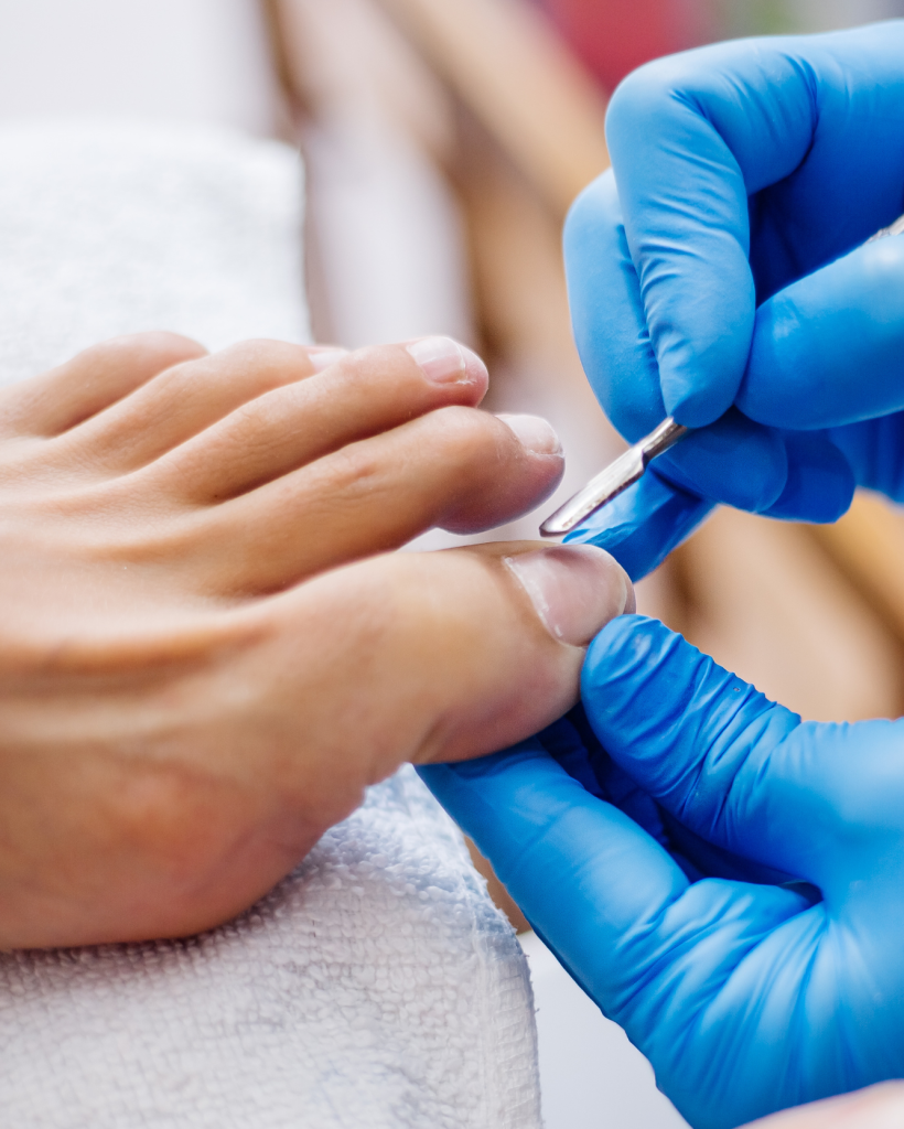 Waterless Medical Pedicure